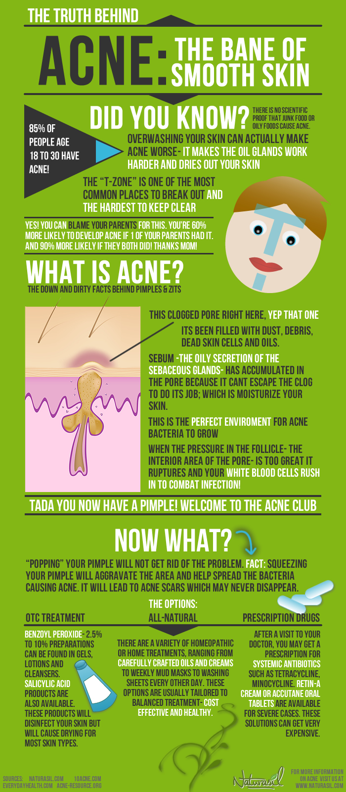 ACNE The Bane Of Smooth Skin Infographic Facts